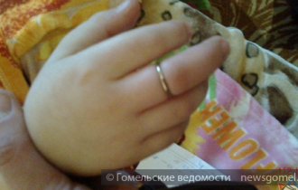 Фото: В Гомеле спасатели помогли ребёнку снять кольцо со среднего пальца