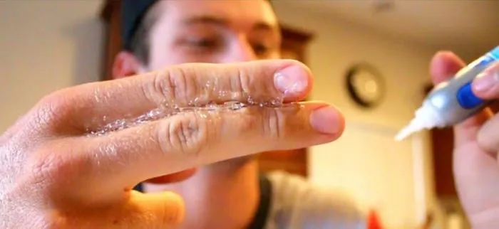 Фото: Лучшие способы убрать суперклей с кожи и не только